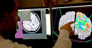 First biological marker for major depression could enable better diagnosis and treatment