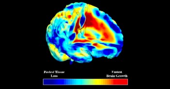Family problems experienced in childhood and adolescence affect brain development