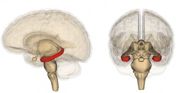 Reduction in volume in hippocampus region of brain seen in psychotic disorders
