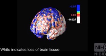 Neuroscience ‘used and abused’