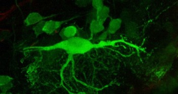 Research of zebrafish neurons may lead to better understanding of birth defects like spina bifida