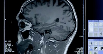 Study: Civic engagement may stave off brain atrophy, improve memory