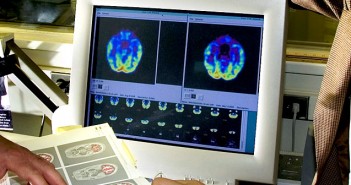 Optical brain scanner goes where other brain scanners can’t