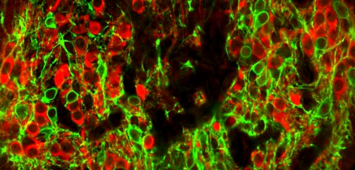 Neuroscientists identify the brain’s on-off switch for thirst