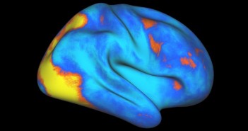 Researchers focus on cell membranes to develop Alzheimer’s treatments