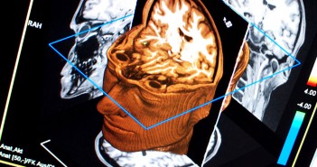Ego death: Brain scans show how LSD can make us lose our sense of self