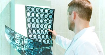 Study examines risk, risk factors for depression after stroke