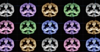The search for happiness: Using MRI to find where happiness happens