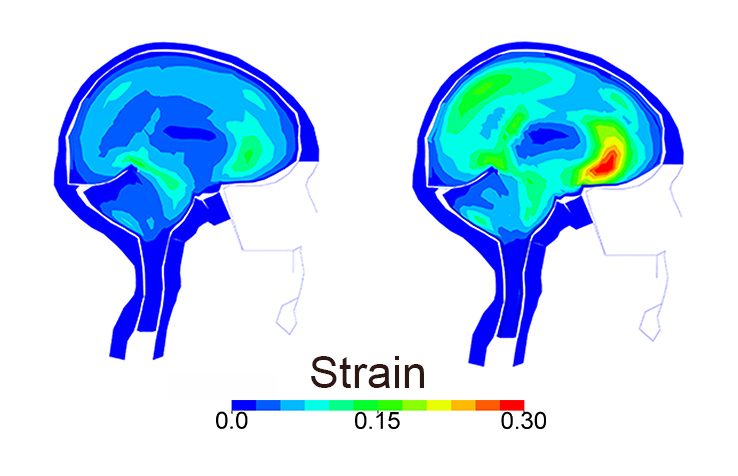 The image on the right indicates the level of strain on brain tissue after an actual bike crash; the image on the left shows what the strain would have been if a helmet was worn. (Image: KTH Royal Institute of Technology)
