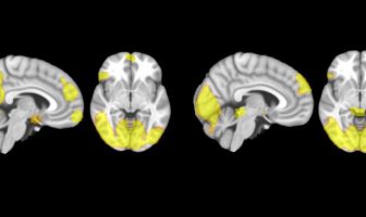 The brain of male batterers functions differently than that of other criminals