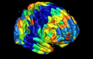 Frequent alcohol drinking kills new brain cells in adults