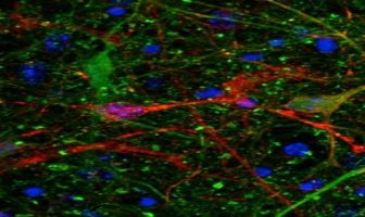 Brain protein predicts recovery time following concussion
