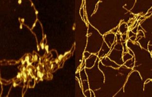 Proteins produced by gut bacteria may cause misfolding of brain proteins