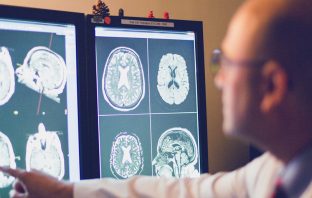 Study finds Alzheimer’s manifests differently in Hispanics