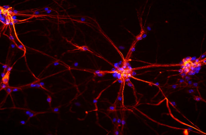 mch neurons mouse brain