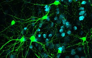 Brain wiring affects how people perform specific tasks