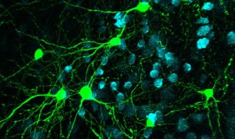 Brain wiring affects how people perform specific tasks