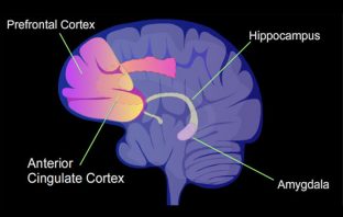 Hyperactivity of brain regions observed during ruminative thinking in teens recovering from depression