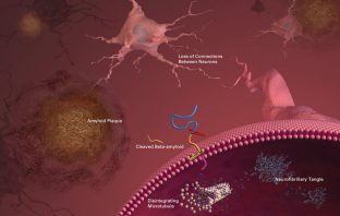 Scientists seek to neutralize ‘rogue’ protein believed to be key player in Alzheimer’s