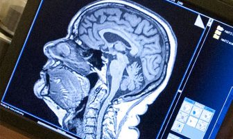 Drug addiction isn’t about bad habits, fear of withdrawal or a selfish search for pleasure — it’s about the brain