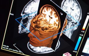 Even if genes affect intelligence, we can’t engineer cleverness