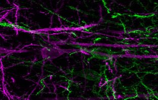 Researchers uncover brain circuitry central to reward-seeking behavior