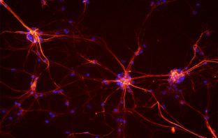 Why are neuron axons long and spindly? Study shows they’re optimizing signaling efficiency