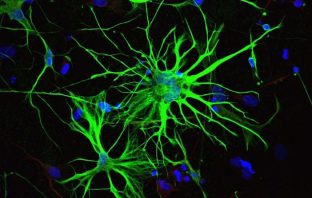 Brain astrocytes linked to Alzheimer’s disease