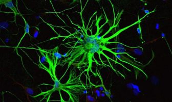 Updated brain cell map connects various brain diseases to specific cell types
