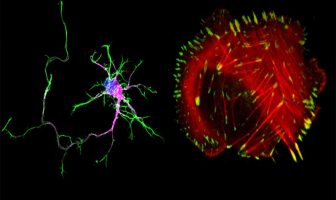Researchers discover an unexpected link between cancer and autism