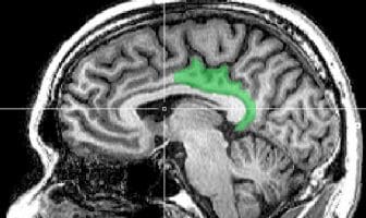 Study finds: Some memories are more vulnerable to dementia than others