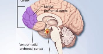 Neuroimaging study links brain activity in the prefrontal cortex to certain psychopathic traits