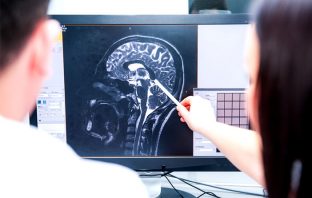Complications at birth associated with lasting chemical changes in the brain