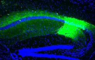 Major breakthrough identifies new mechanism for the development of schizophrenia