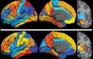 A psychiatrist explains how seeing problems in the brain makes stigma disappear