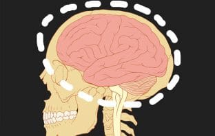 Callous and unemotional traits linked to brain structure in boys but not in girls