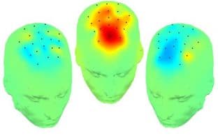 Low frequency brain stimulation improves cognition in Parkinson’s disease