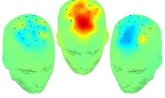 Low frequency brain stimulation improves cognition in Parkinson’s disease