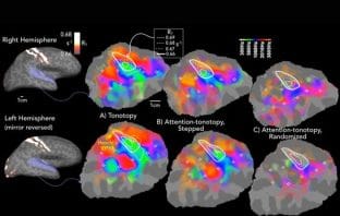 Selecting sounds: Imaging study reveals how the brain knows what to listen to