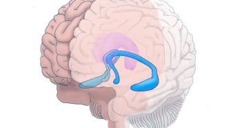 Problematic alcohol use linked to reduced hippocampal volume