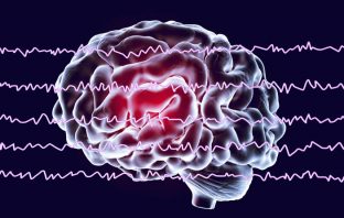 EEG can determine if a depressed patient will do better on antidepressants or talk therapy