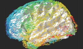 Waves move across the human brain to support memory