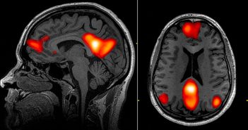 Childhood adversity linked to reduced inhibitory control and alterations in key brain networks