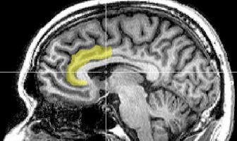 Cannabis use associated with abnormal brain structure in region involved in processing facial emotion