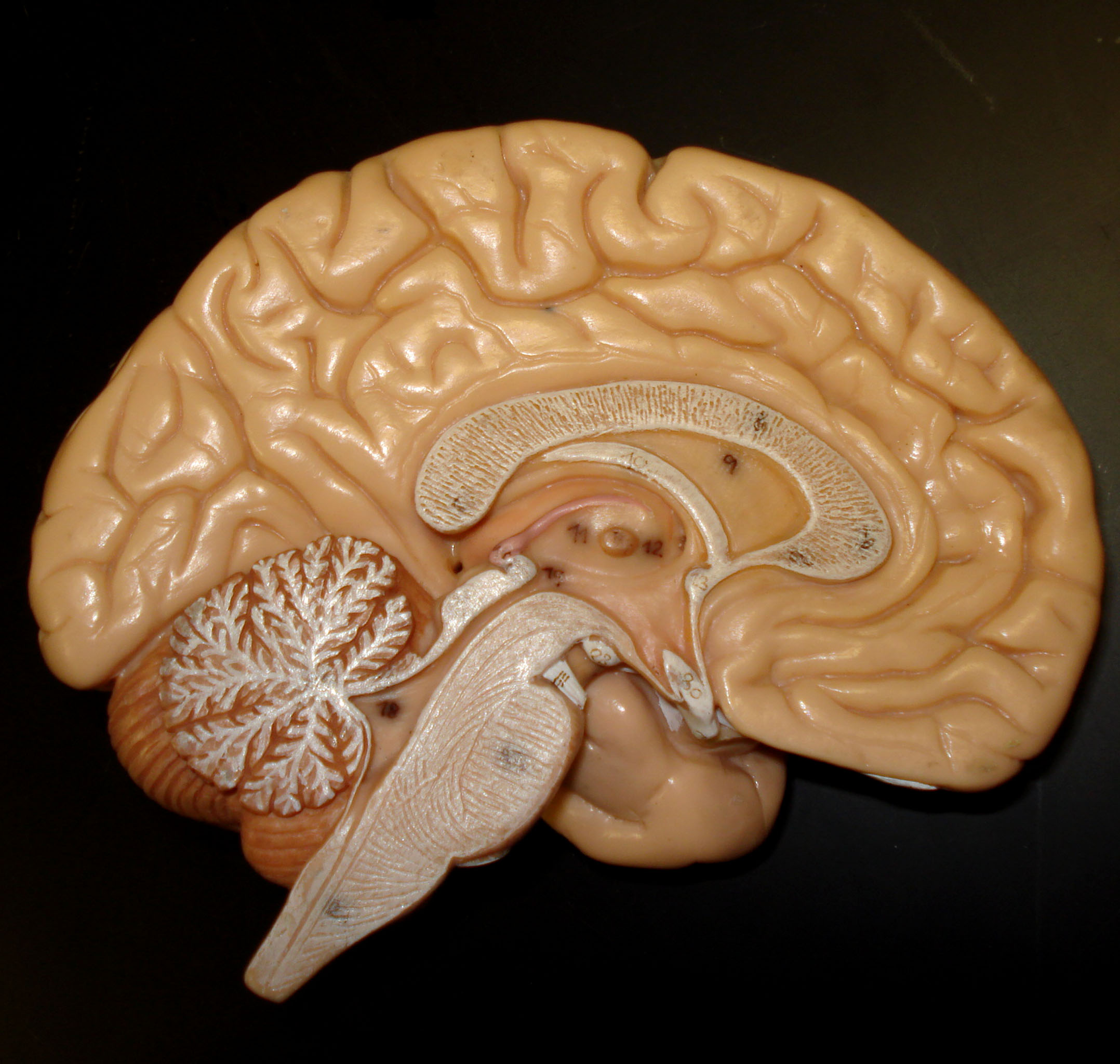 Researchers look into the brains of chronic itch patients