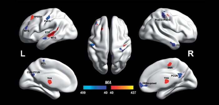 Autistic and non-autistic brain differences isolated for first time