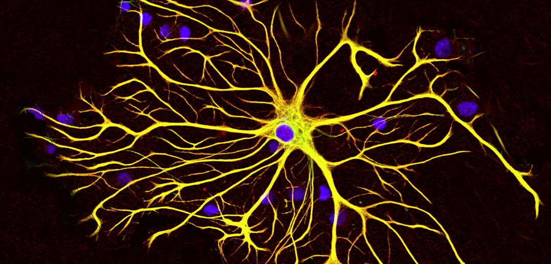 Cells called astroglia zip the two halves of the brain together