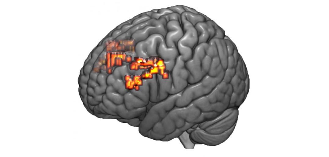 Small brains. Dorsolateral prefrontal Cortex. Скан мозга. Мозг link. Mathematical Brain