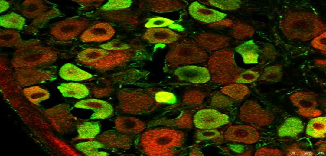 Study Pinpoints Autism Linked Protein >> Autism Linked Protein Crucial For Feeling Pain Study Pinpoints Autism Linked Protein >> Autism Linked Protein Crucial For Feeling Pain